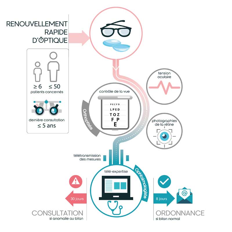 Parcours de votre consultation RNO / RNM au Cabinet Ophtalmologie de Tours